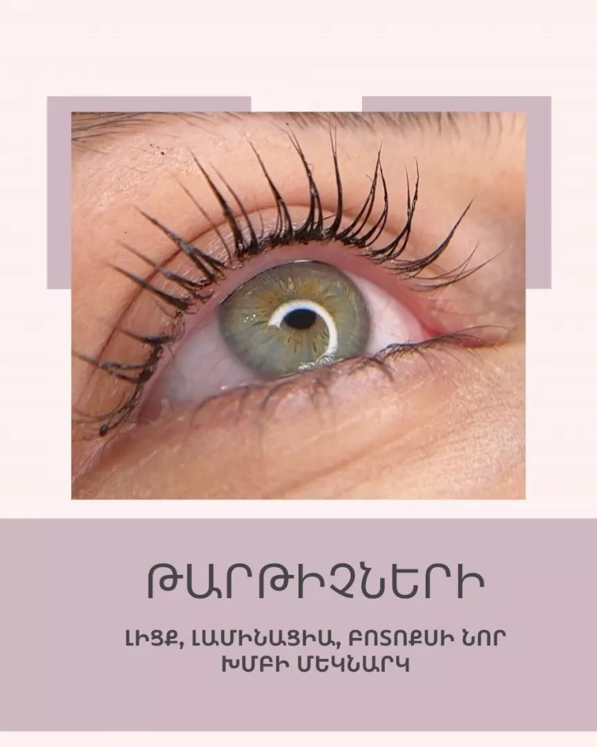 Թարթիչների լիցք,լամինացիա